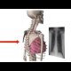 VIDEO Chest X-Ray Basics in 5 min (Youtube: Nick Smith)